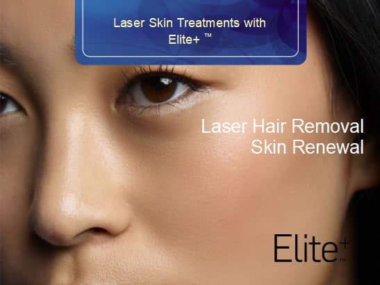 Laser Hair Removal with Elite+™ | Laser hair removal